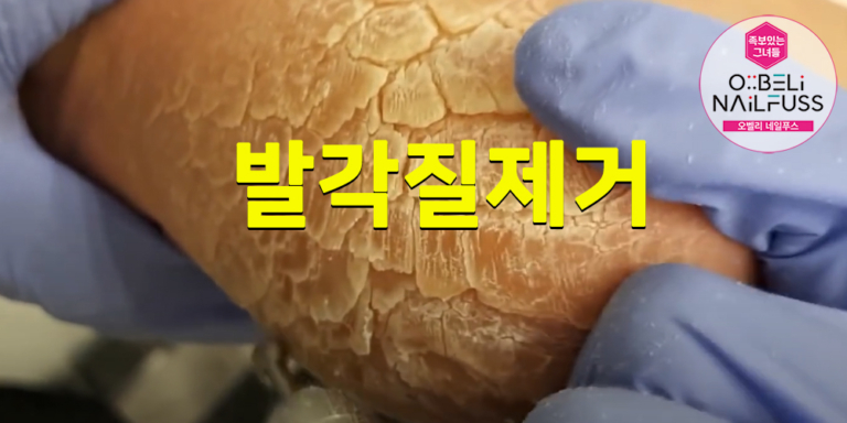 발각질제거