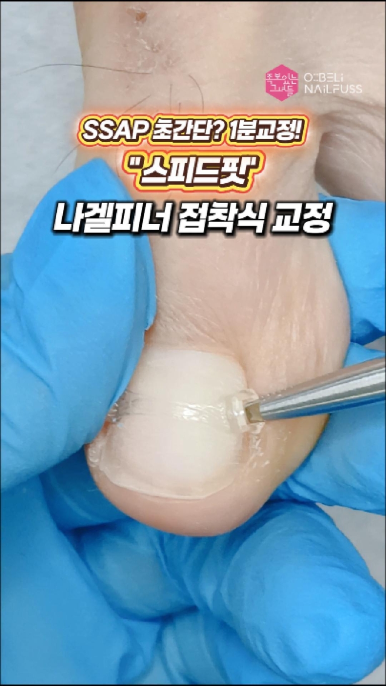 064_교정기_나겔피너_02_Cover